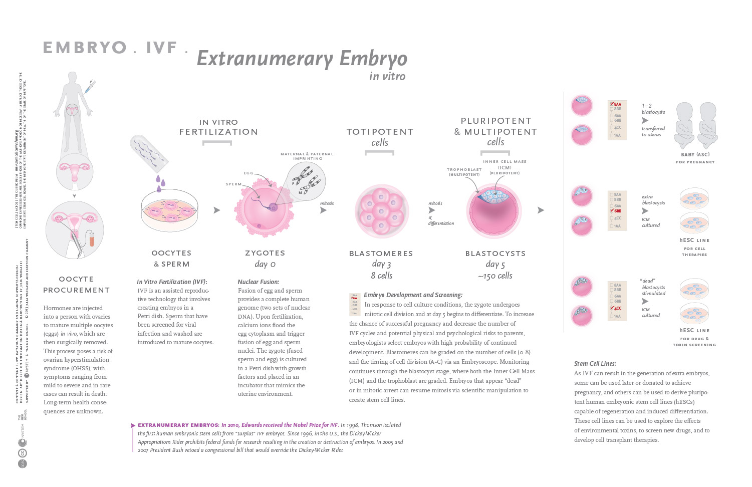 infographic