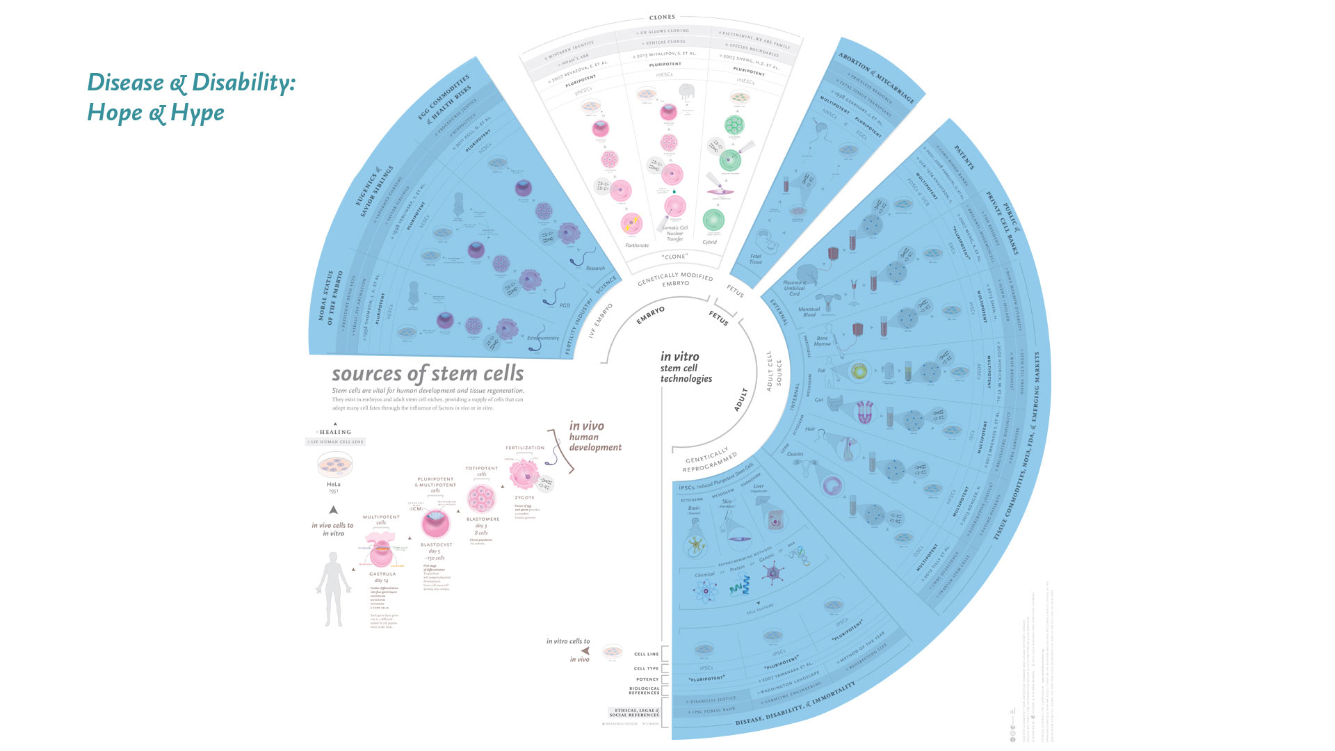 infographic