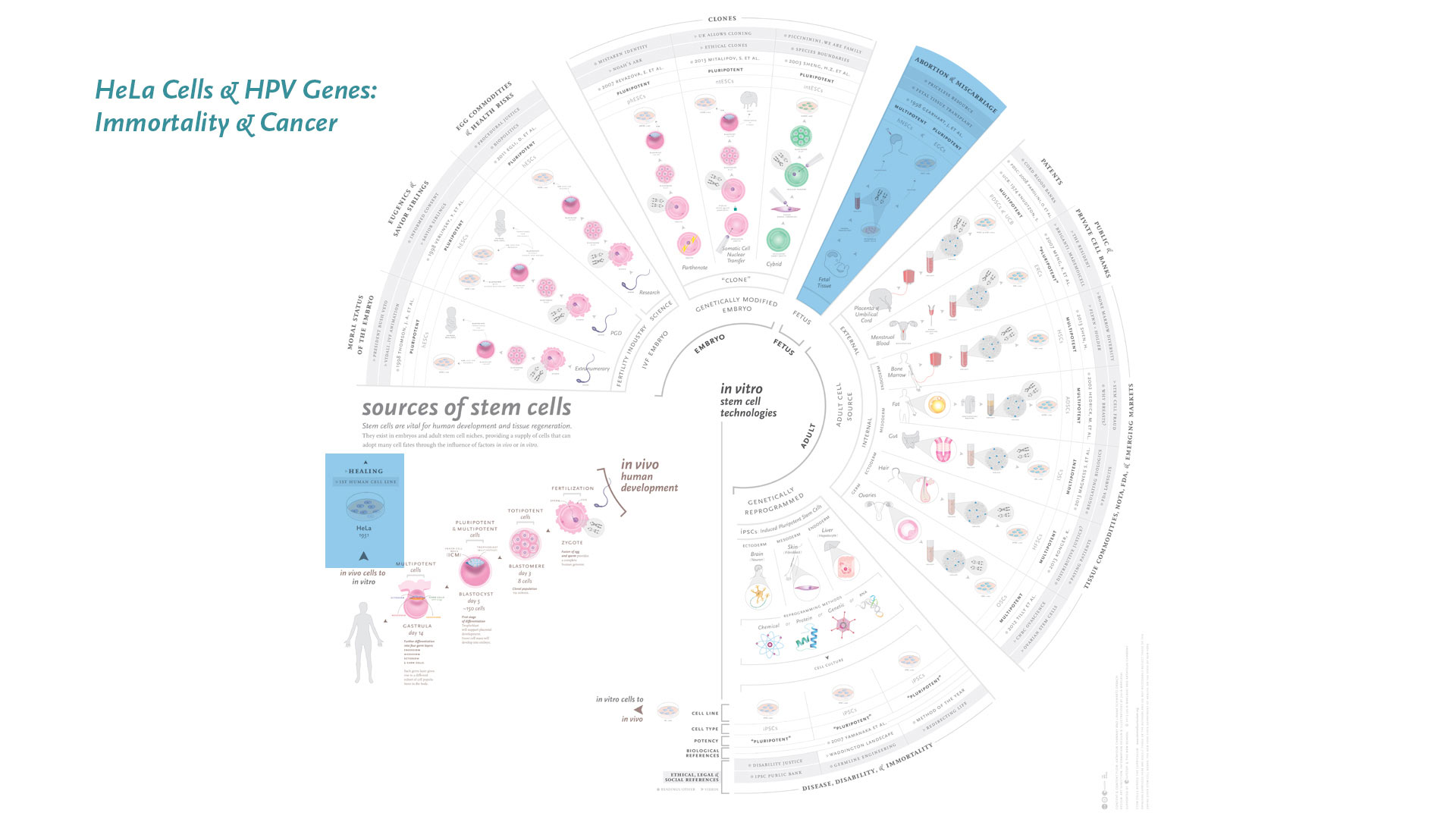 infographic